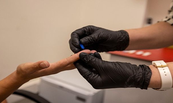 Büyükşehir’den kimliksiz ve ücretsiz test hizmeti